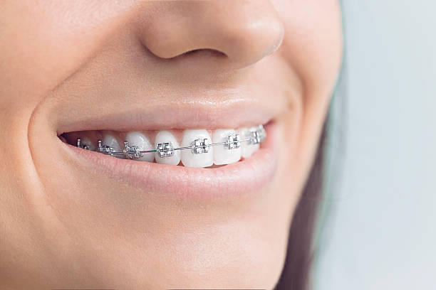 Laser Dentistry in Riviera Beach, MD